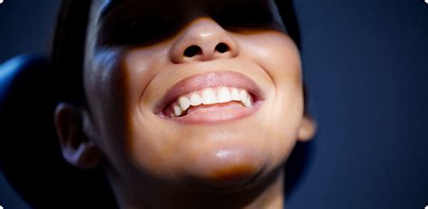 How long does magic teeth whitening last? Tips to maintain your bright smile